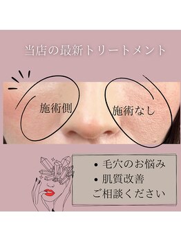 ミスティビオ 平尾店(mistyBIO)/《毛穴縮小》