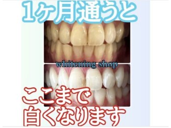 ホワイトニングショップ 京都駅前店/継続こそ「美」への最大の近道!