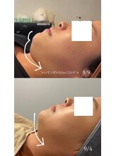 モア(more.)&nbsp;脂肪分解 排出促し♪