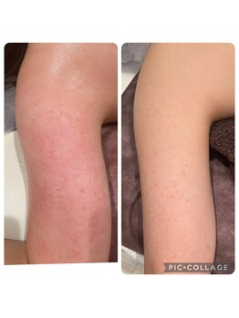 ラナン(ranan)/ブライダル