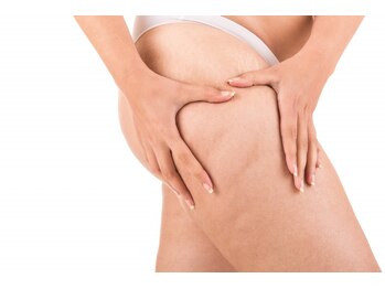 ベルア(Bellelea)の写真/年齢とともに落ちにくい脂肪へ◇結果重視の本格痩身【エンダモロジーアライアンス】大人女性の為の痩身を★