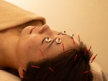 眼精疲労に効くお目元のお灸が人気♪デスクワークの方にオススメ