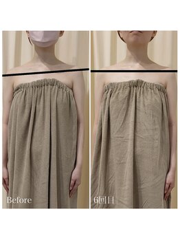 ルノン(Lunon)/《不調改善》