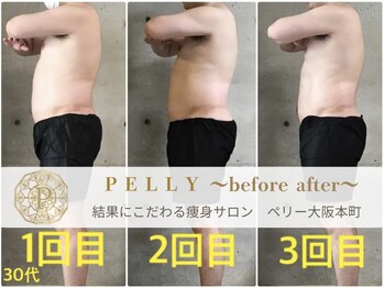 ペリー(PELLY)/男性30代　before after