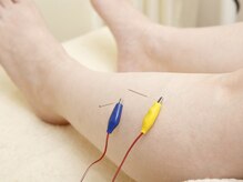 ケイトリート鍼灸マッサージ院/深いところまできかせる