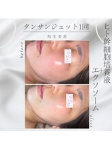 デール(R:DeeL)/都内では5万円…？！