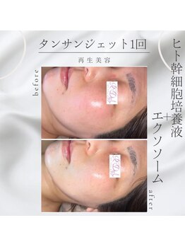 デール(R:DeeL)/都内では5万円…?!