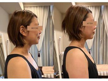 メグムサロン(Megumu Salon)/小顔矯正/マッサージ/エラ張り