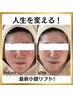 【エステ小顔人気No1☆】人生を変えるうる艶肌!!!私史上最高の小顔美人に♪