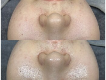 クリスタルビューティ 渋谷/NEW【XE'LHAセラピール】