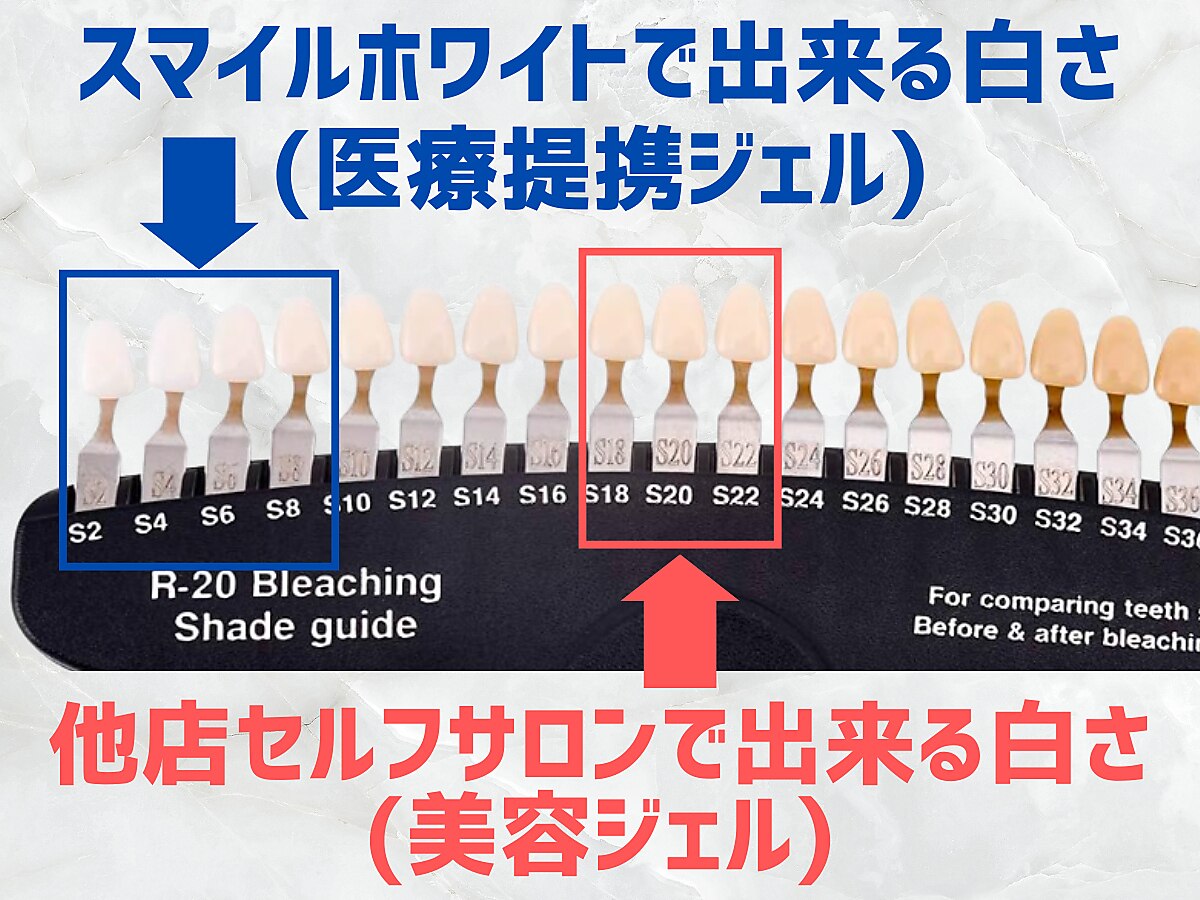 スマイルホワイト 赤羽店｜ホットペッパービューティー