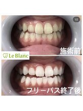 ルブラン 奈良店(Le Blanc)/身だしなみの新常識！