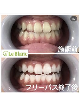 ルブラン 奈良店(Le Blanc)/身だしなみの新常識！