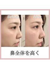 ラプリ 福岡博多店(Raplit)&nbsp;before after