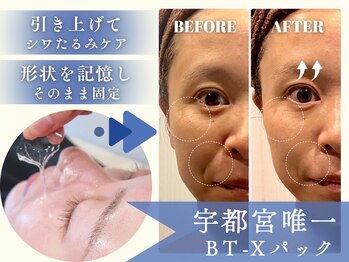 モルティー 宇都宮本店(Molti)の写真/【シミしわ・くすみに徹底アプローチ！】化粧ノリが変わる！透明感あふれる均一な肌へ導く、美肌専門サロン