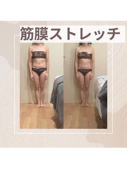 トトノエル(TOTONOEL)/筋膜ストレッチ（オールハンド）