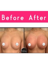 エルフラージュ 銀座店/年齢なんて関係ないハリツヤ胸