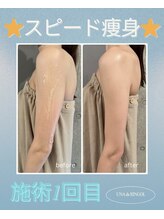 ウナ デ リンゴル 恵比寿店(UNA de Ringol)/ボディ痩身¥18,000