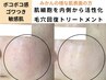 【開き毛穴・しずく毛穴・たるみ細胞ケア】毛穴回復トリートメント