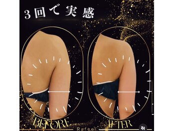 ラフィール/ブライダルエステ