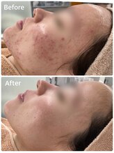 スハダビ110(suhadabi110)/before　after