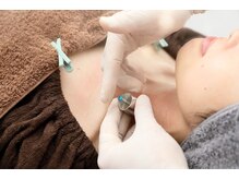 ダーマペンより痛くなく、ダウンタイムのないダーマ鍼☆