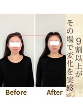 スウ(suu.)/Before-After【30代】1回
