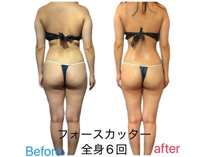 ラビーバ(Ravviva)の写真
