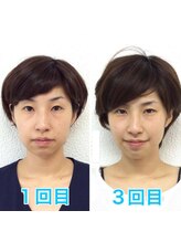 ビューティスタジオＫ/たるみ改善小顔矯正フェイシャル