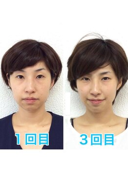 ビューティスタジオＫ/たるみ改善小顔矯正フェイシャル