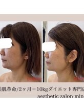 ミノ 美里大通り店(mino)/やみつきフェイシャル♪