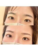 ベル フルール(Bell Fleur)/セット施術前後