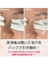 ルル(RuRu)/毛穴洗浄