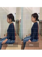 たんぽぽ整骨院鍼灸院/ストレッチ整体