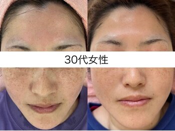 サクラ 本厚木駅前店(SAKURA)/40代前半 11回目