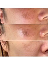 ル ボヌール/エステを超える!？