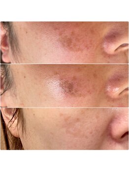 ル ボヌール/エステを超える!?