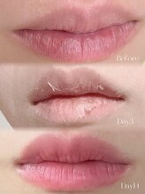 癒える(ielu)/ローマピンク★リップ