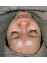 ユズドット(yuzu.)/生ヒアルロン酸導入で水光肌育成