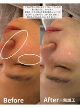 ニコ(nico)/くすみ・皺は「今」ケアして。