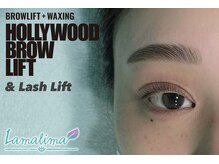 ラマリマ(Lamalima)