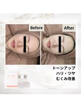 ルアナ(Luana)/ララピールの効果★