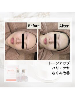 ルアナ(Luana)/ララピールの効果★