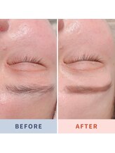 ランプシー(Lampsi)/平行アーチ眉