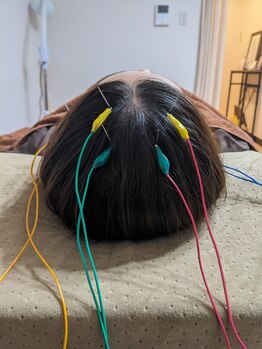 乃々鍼灸整体院 表参道/頭部鍼通電施術
