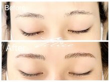 フェリーチェ(Felice)/ハリウッドブロウリフト