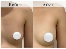 バストアップ専門サロン D'cielの雰囲気(20代のお客様下乳ラインを造りバストの存在感が出現しました)