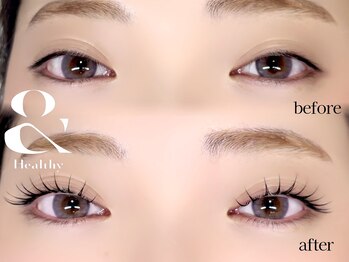 アミニー(Aminy)の写真/エクステの種類が豊富で下がりまつげも上向きへ。アンドヘルシーで瞳を華やかに♪