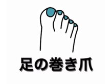 ネイルサロン ネイルズゴーゴー 渋谷店(NAILSGOGO)/巻いた爪 フット 足の爪