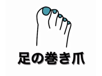 ネイルサロン ネイルズゴーゴー 渋谷店(NAILSGOGO)/巻いた爪 フット 足の爪